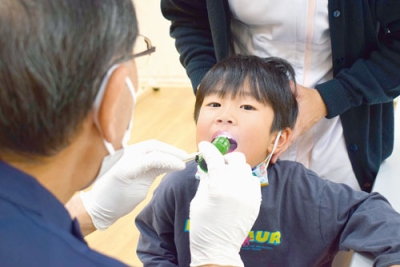 写真：大きく口を開き歯科検診を受ける子ども